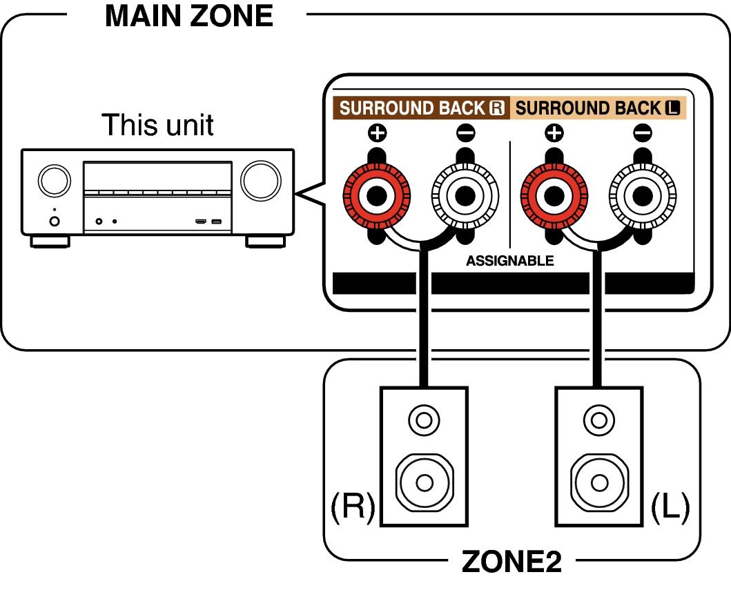 Pict ZONE Audio1 X15E3